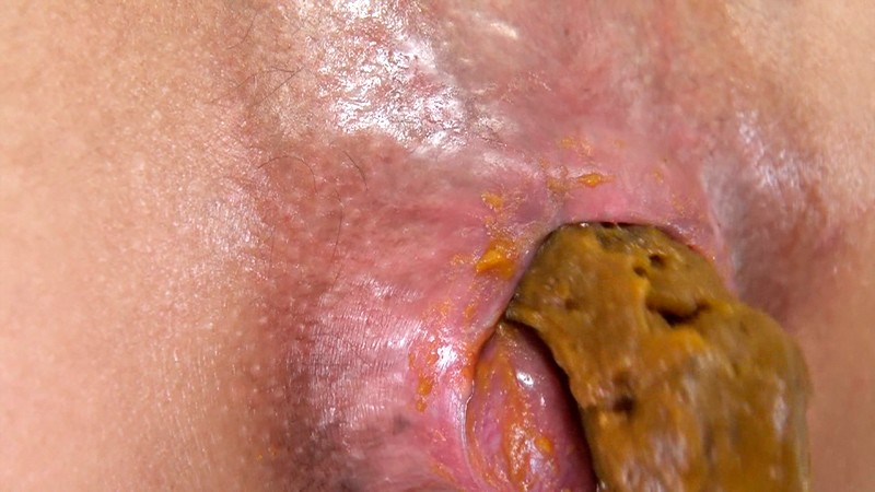 【顔出しNG】パクパク♪ヤバい脱肛を見せてウンコ出しする素人女